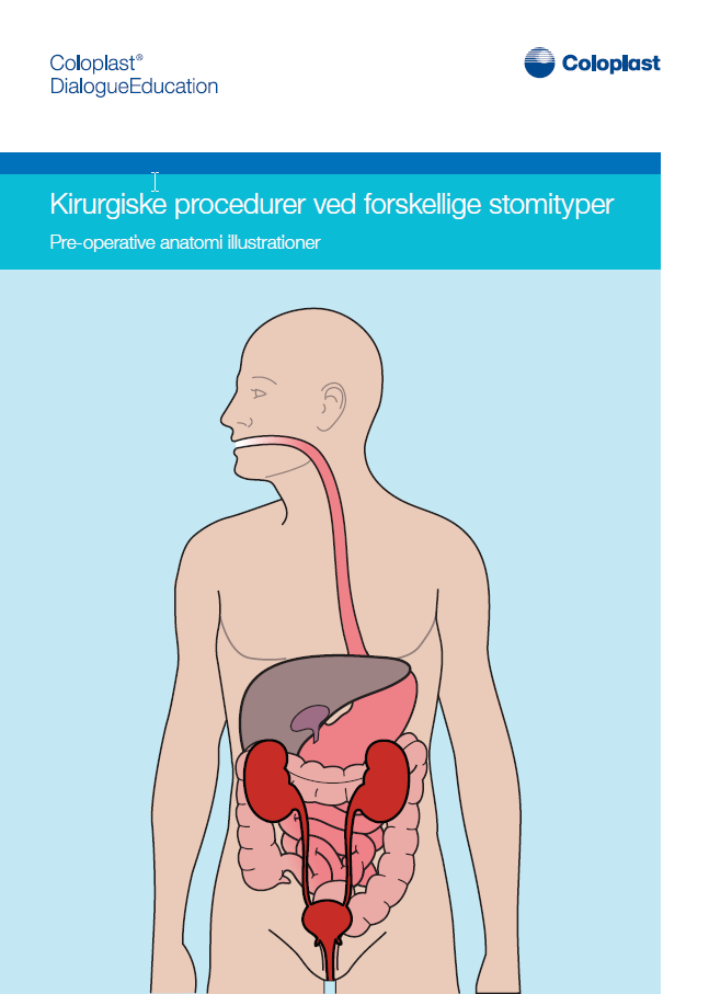 Kirurgiske procedurer