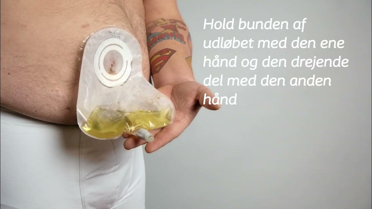 NY urostomipose med drejelukning 2-dels Click Convex