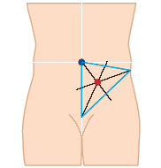 Stomimarkering